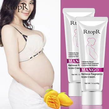 

2PCS Mango Stretch Marks Repair Cream Remove Pregnancy Scars Acne Treatment Maternity Anti-Aging Anti Winkles Firming Body Cream