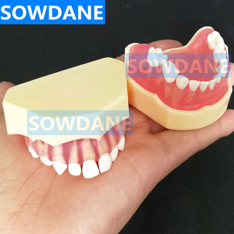  Dental 1:1 Study Teaching Model Dental Children Standard Model Removable Teeth Soft Gum Kid TYPODON - 4000170129781