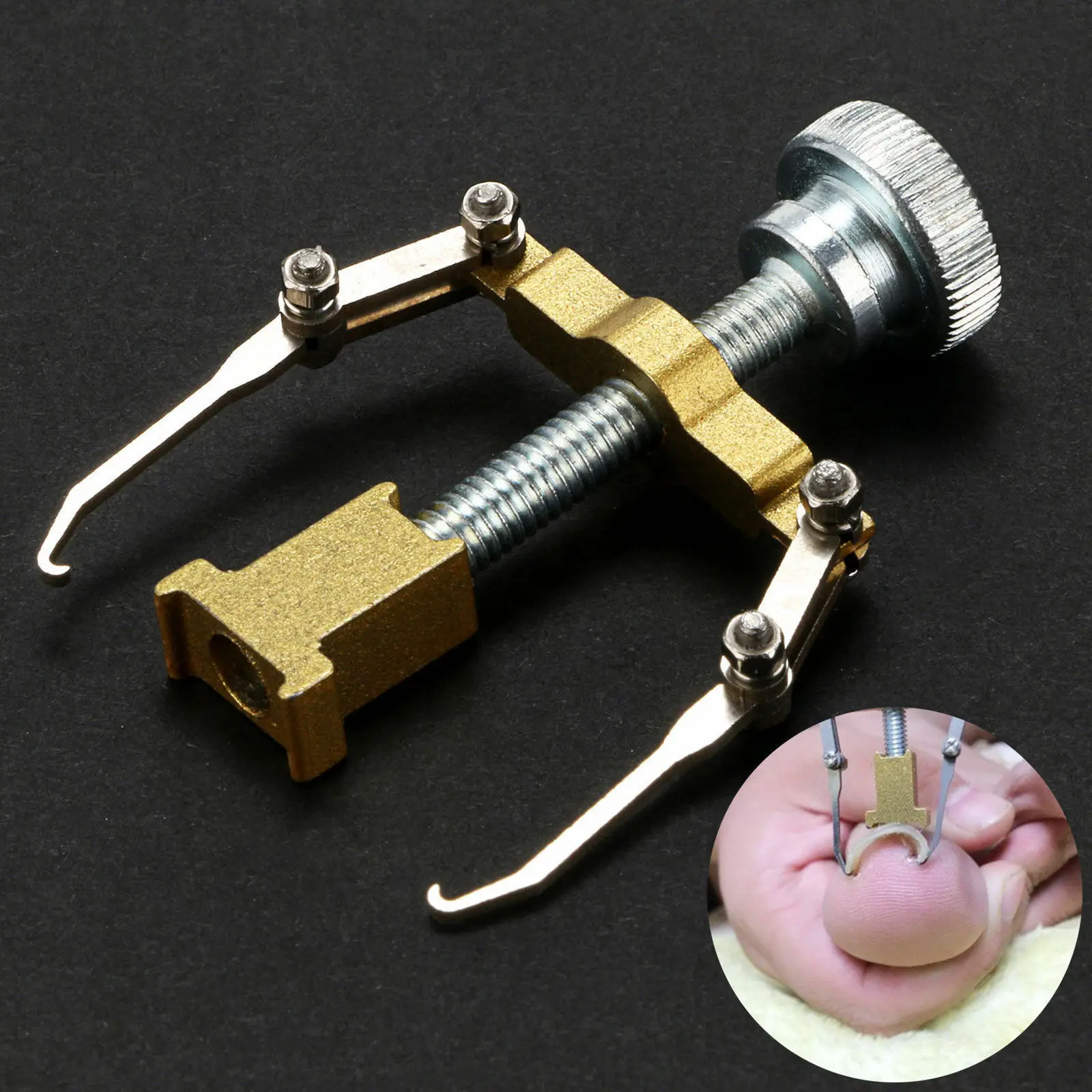 Сталекс инструменты для педикюра. Инструмент для вросшего ногтя. Инструмент для исправления. Ножки приборные. Инструмент для коррекции вросших ногтей корректор.