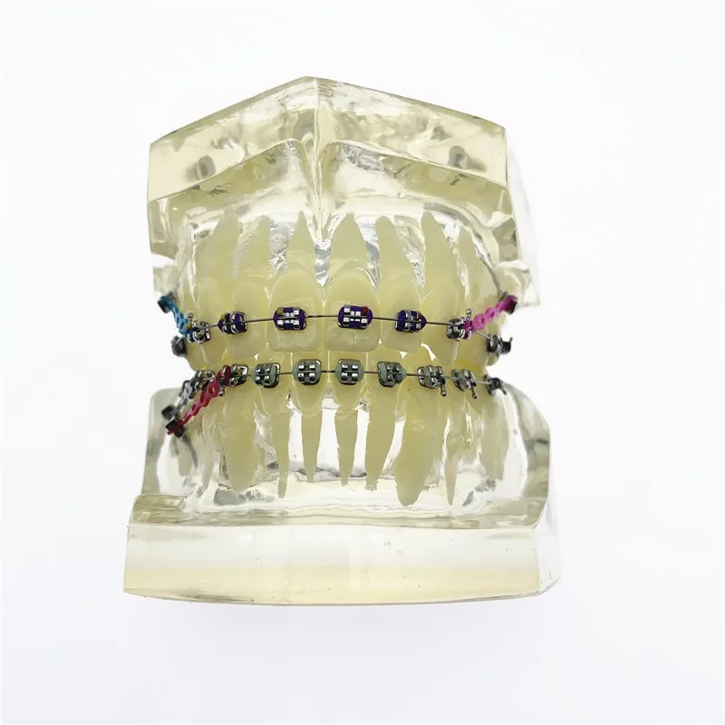 Colorful Brackets Study Model Transparent Teeth With Dental Orthodontic Malocclusion Orthodontic Model