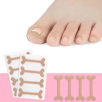 

4pcs Professional Embedded Toe Nail Corrector Sticker Toenail Care Pedicure Thumb Curl Correction Sticker