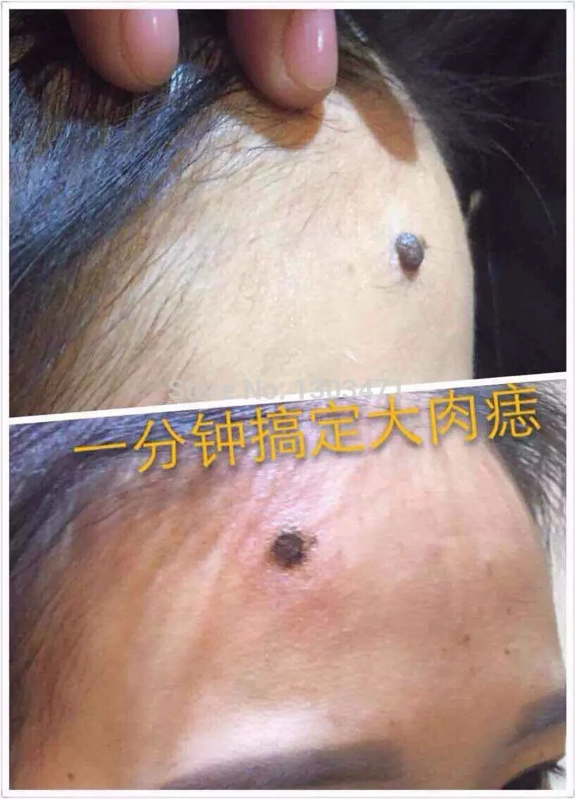 HTB1k0AKKFXXXXcOXFXXq6xXFXXXW