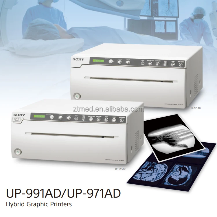 Sony impresora de ultrasonido médica UP 991AD, máquina de impresión  analógica y Digital, A4, papel térmico blanco y negro y película  azul|Piezas para herramientas| - AliExpress
