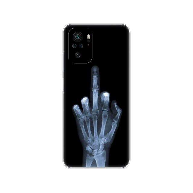Xiaomi Redmi Note 10 10S Case 4G 5G Silicon Soft Tpu Back On Redmi Note 10 Pro Global Phone Cover Note10 S Bumper Etui Funda