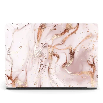

A1932 Case for Mac book Air 13.3 inch Marble Glitter Matte Clear Hard Cover for Apple Macbook Air 13 Case A2179 2020 Coque Funda