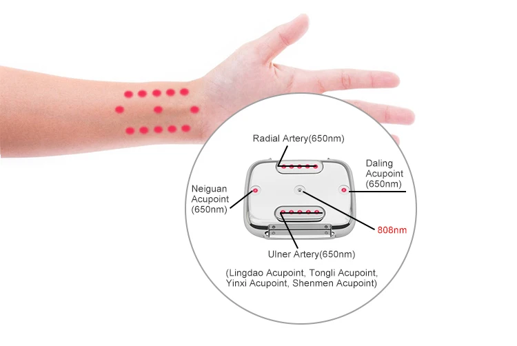 3 в 1 красный светильник для холодной лазерной терапии часы Semaiconductor LLLT наручные часы для дома пожилых диабет ринит боль в мышцах