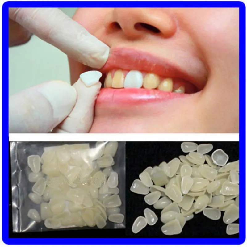 70PCS/Pack Ultra-Thin Dental Temporary Crown Ultra Thin Sticker Resin Tooth Whitening Teeth Upper Anterior Shade | Красота и здоровье