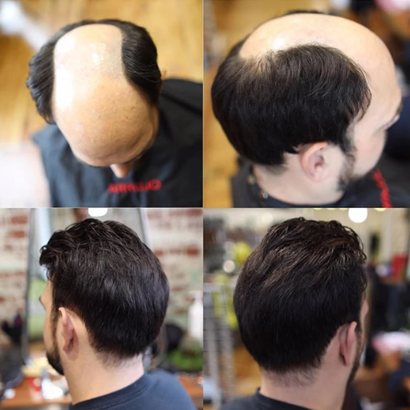 Кружевной передний парик из французского кружева с кожей Pu сзади Q6 база кружева человеческих волос накладка из искусственных волос для