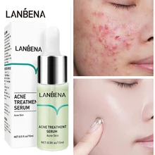 

Salicylic Acid Acne Removal Serum Anti-Acne Oil Control Fade Acne Spots Moisturizing Inflammation Repair Face Skin Care Products