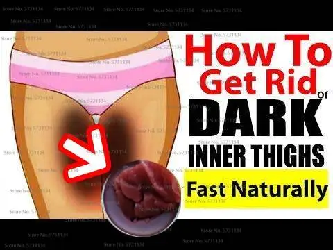 Inner Thigh Whitening Cream, Spotless Inner Thigh, Spots Remover, Fast Action