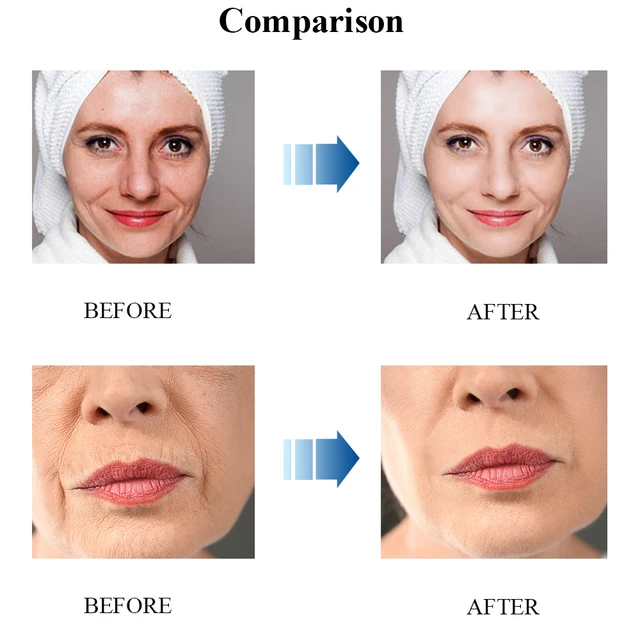 Envisha Nyaki Retinol Arckrém-Vitamin-Kollagén Fehérítő Ráncellenes Öregedő Hidratáló Bőrápolás Hialuronsav Fehérítés - Image 5
