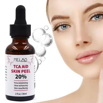 

30ml Trichloroaectic Acid 20% Skin Peel Pore Minizing Wrinkles Spots Skin Care Face Serum