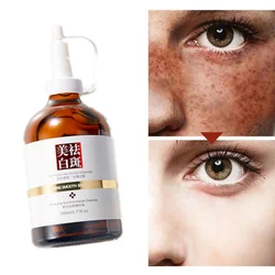 Whitening and Anti-freckle Essence, Moisturizing, Refreshing and Moisturizing Skin Care, Brightening Skin Tone Serum