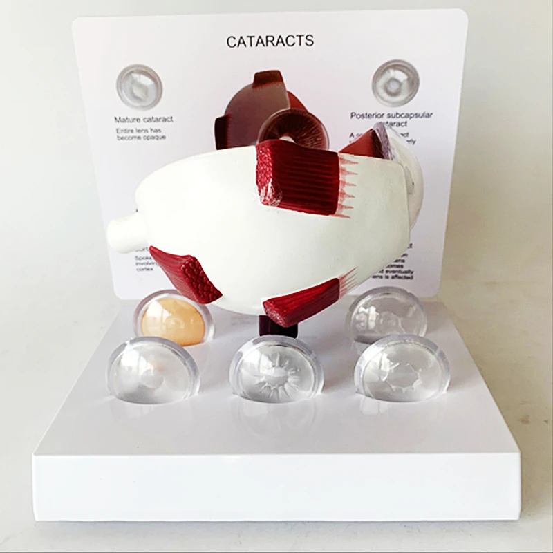 Рисунок 2 - 4X человеческий ПВХ глаз катаракта