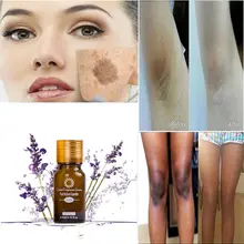 Отбеливающий Осветляющий растительный эфирное масло белый без масла Природный уход за кожей Чистота