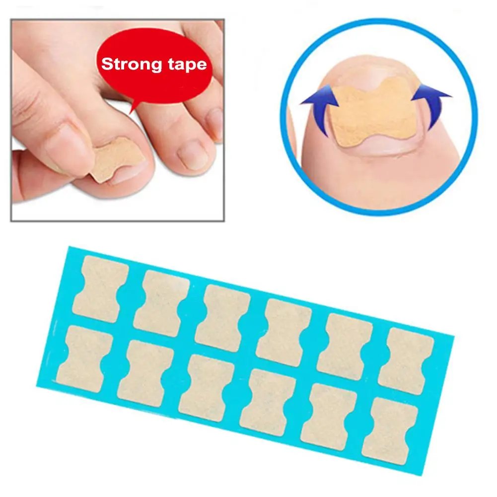 36/72PCS Ingrown Toenails Correction Patch Physical Straightening Elastic Toenail Pedicure Stickers Brace Bunion Corrector
