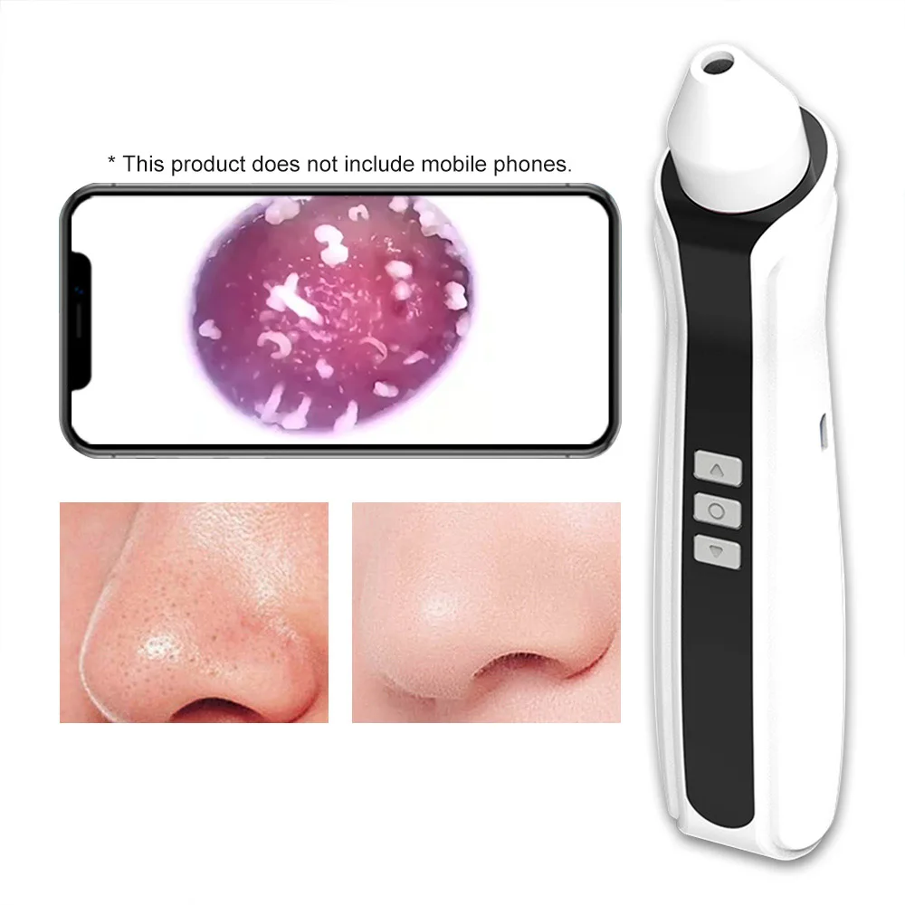 

Visual Blackhead Remover USB Rechargeable Vacuum with Camera Acne Comedones Removal Pore Deep Cleaner Face Care Pimples Tools