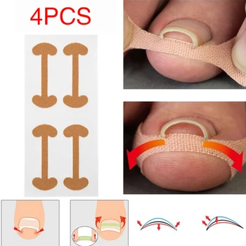 

Foot Corrector Stickers Ingrown Toenail Useful Curved Nail Stickers Toe Nail Pedicure 4 PCS Straightening Correction