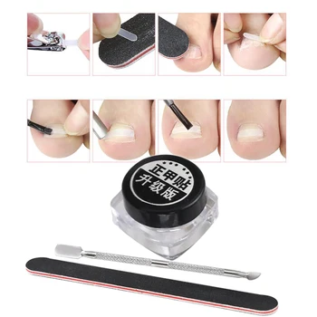 

Professional Ingrown Toenail Corrector Stickers Pedicure Tool w/Pusher Nail File Foot Rasp Foot Care Tools