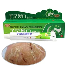 Мощный крем от трещин для рук, пятки, обветренный пилинг для ног и рук, против сухих трещин, уход за кожей, китайская мазь