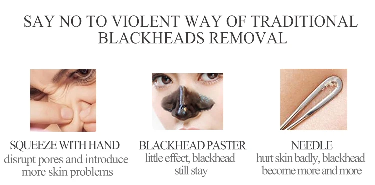 treading products electric blackhead removal skin care device
