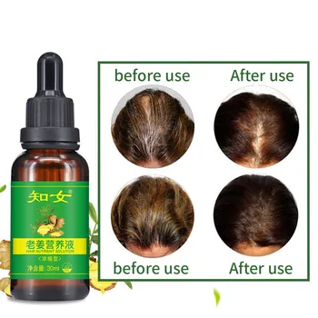 

30ml Professional Nutrient Serum Conditioner Liquid Care Tonic Loss Treatement Effective Ginger Shampoo Hair Growth Essence