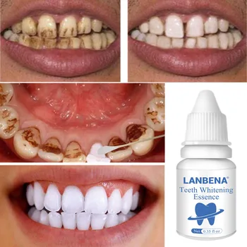 

10 ML Magic Natural Tooth Whitening Powder Oral Hygiene Cleaning Removal Tartar Yellow Smoked Tea Stains Tooth Cleaning Liquid