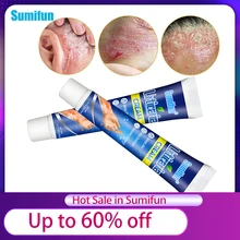 1/2/3Pcs Urticaria Cream Herbal Antibacterial Psoriasis Treatment Ointment Itchy Skin Relieve Eczema Anti-Itch Health Care