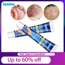 1/2/3Pcs Urticaria Cream Herbal Antibacterial Psoriasis Treatment Ointment Itchy Skin Relieve Eczema Anti-Itch Health Care