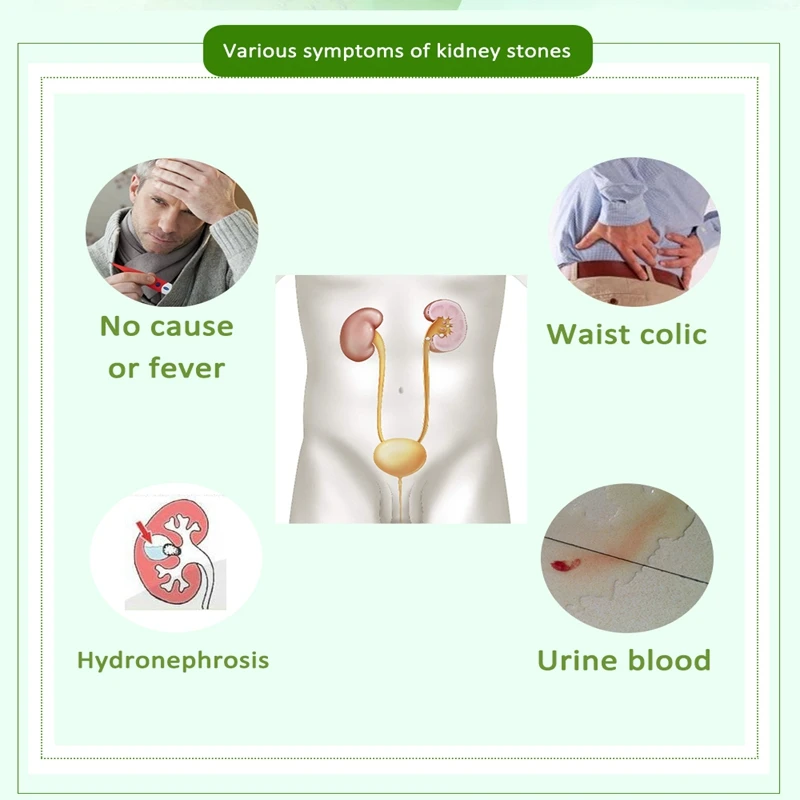 40 pcs/2 Packs Kidney Stone Cleaning Tea gallbladder Kidney stone treatment cleaning kidney gallstone product draining Stone tea