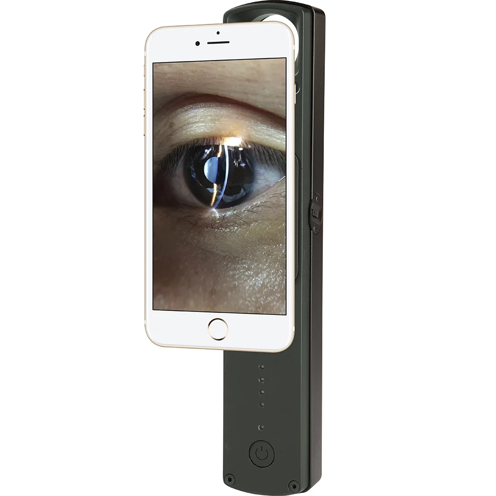 Ophthalmic Portable Slit Lamp All In One Handheld Type