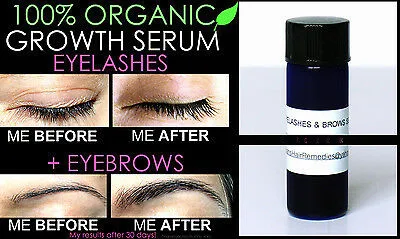 

BEST SUPER FAST Hair Growth System Natural Hair Growth Products kit eyelashes eyebrows growth of 3