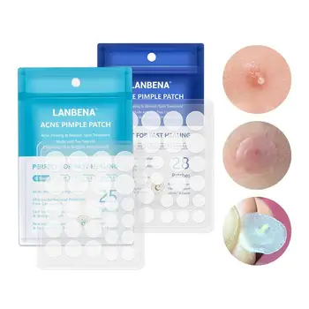

Acne Pimple Patch Invisible Acne Stickers Blemish Treatment Acne Master Pimple Remover Beauty Tool Skin Care