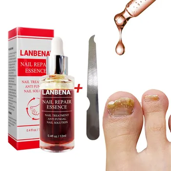 

Foot Antifungal Nail Essential Oil Anti-Fungus Onychomycosis Paronychia Nails Repair Essence Cuticle Oil Nail Oil Nail Treatment