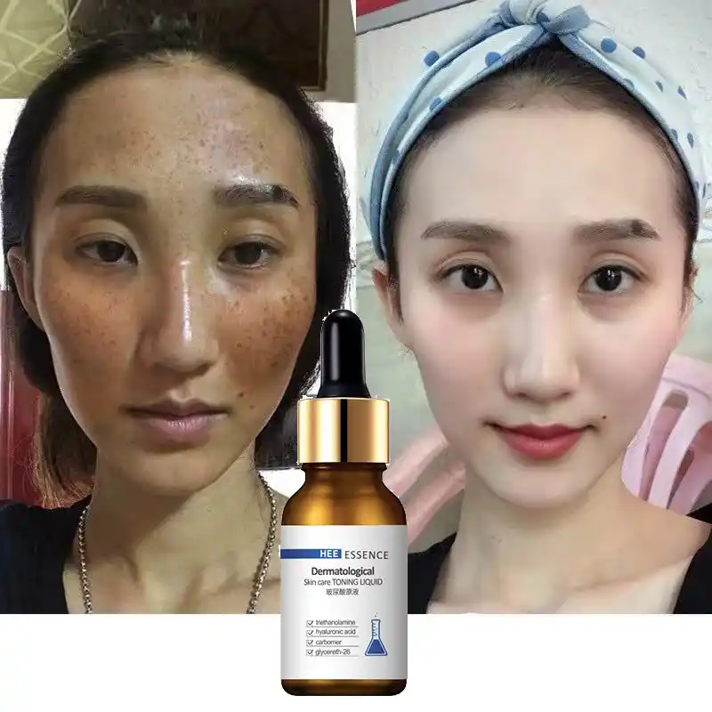 skin whitening korean products
