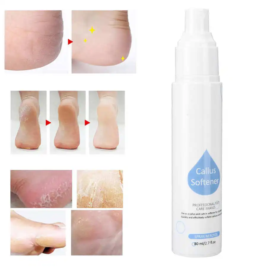 80ml Moisturizing Foot Care Dead Skin Horniness Removal Spray Callus Softener Nail Treatments For Nails Accessories | Красота и