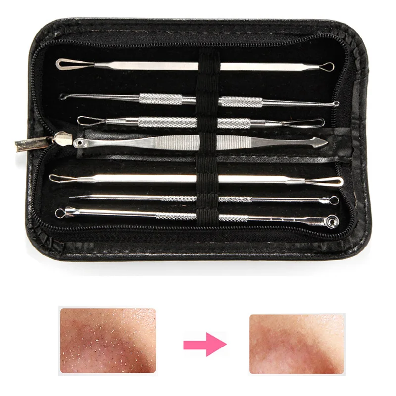

Blackhead Remover Needles Kit 7pcs Acne Comedone Pimple Blemish Extractor Tools Black Dots Spot Pore Cleaner for Face Cleaning
