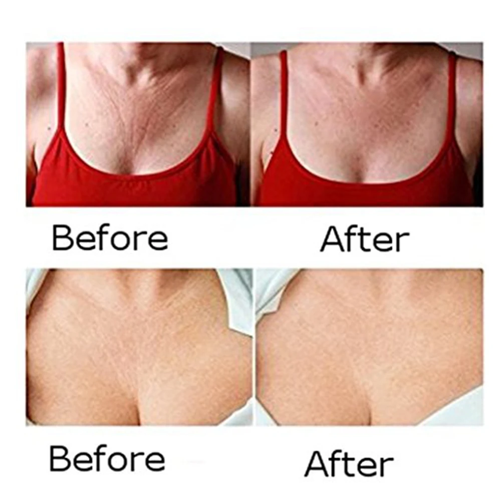 Anti Wrinkle Silicone Gel Chest Pads Reusable Medical Reusable Invisible Self Adhesive Chest Pad Eliminate Fine Lines Wrinkles
