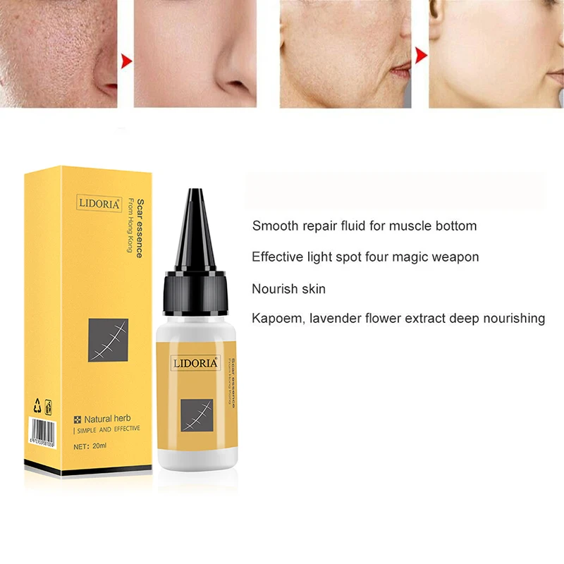 1pc 20ml Herbal Scar Mark Removal Skin Whole Body Care Cream Blemish Treatment Skin Scar Smoothing Repair Fluid Skincare TSLM1