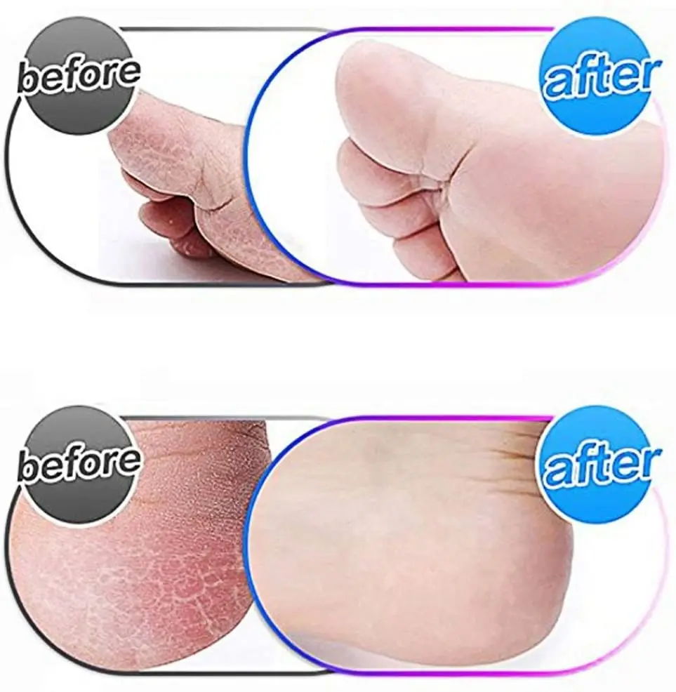 Electric Foot File 40pcs Replacements Roller Heads for Pro Pedicure Foot Care for Feet Electronic Foot File Rollers Skin Remover Accessories