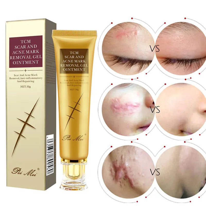 

Scar Cream Gel Acne Burns Stretch Marks Bruises C-section Surgical Repair Smooth Whitening Moisturizing Body Skin Care 30g