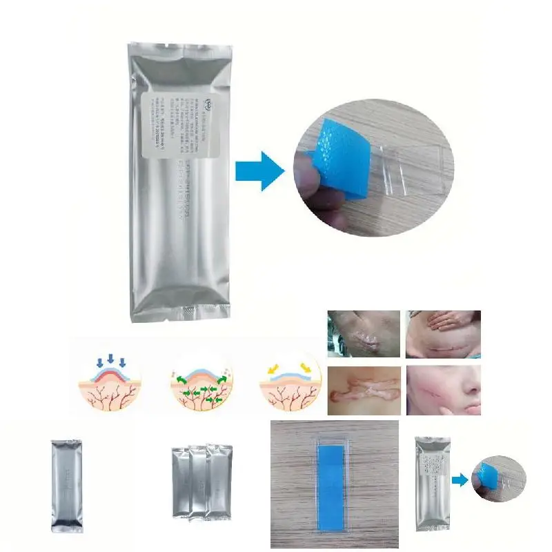 Силиконовый патч для удаления многоразового использования гель от угрей рубцов