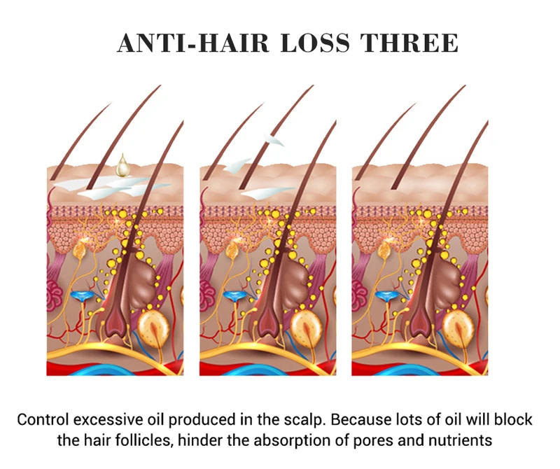 Сывороточная эссенция для роста волос против выпадения волос, лечение кожи головы, укрепление питания корней, ускорение роста волос TSLM2