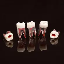1 шт. 1:1 смоляная Стоматологическая эндодонтическая модель зуба с цветным корневым каналом и пульпой модель стоматолога инструменты для обучения студентов
