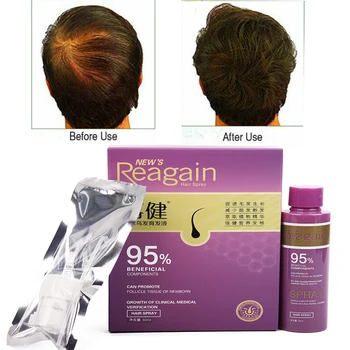 

Fast and dense hair loss natural plant ginseng regenerative essence oil anti-hair loss essence
