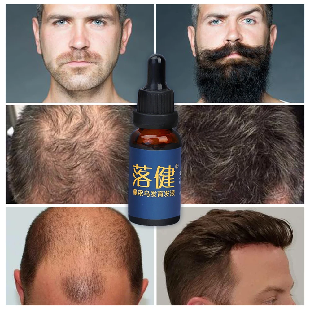 30 мл быстро мощные Продукты для волос уход за волосами Предотвращение облысения против выпадения волос сыворотка питательная для мужчин эфирное масло для роста волос борода