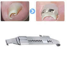 Strumenti per Pedicure dell'unghia del piede incarniti recupero professionale punta incorporata trattamento delle unghie paronichia borsite alluce valgo correttore cura dei piedi