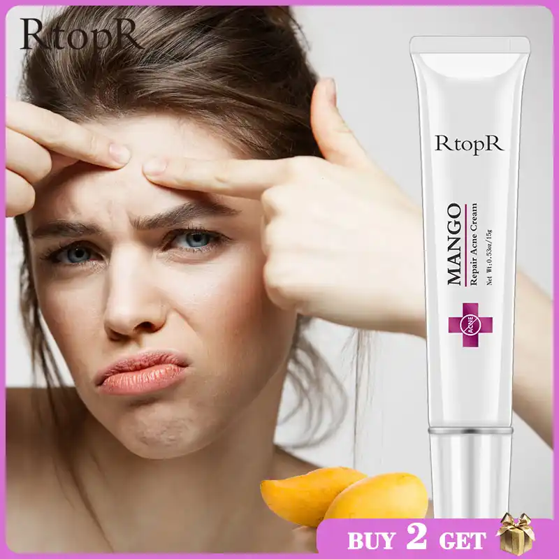 rtopr mango acne cream
