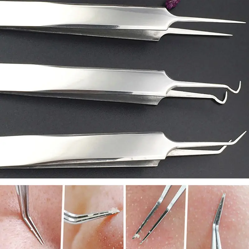 Stainless steel Face Cleaner Useful Straight Bend Curved Blackhead Acne Clip Tweezer Pimple Comedone Remover Kit