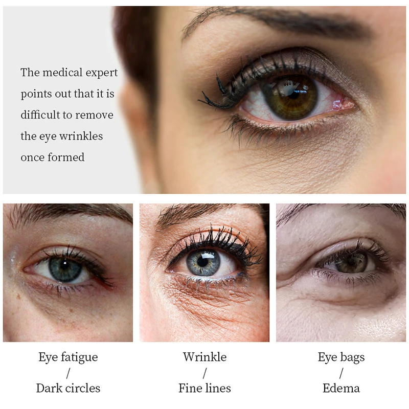 VIBRANT GLAMOUR Polypeptide Eye Mask Anti Aging Remover Puffiness Dark Circles Moisturizing Anti wrinkle Nourish Eye 1 VIBRANT GLAMOUR Polypeptide Eye Mask Anti Aging Remover Puffiness Dark Circles Moisturizing Anti wrinkle Nourish Eye 3